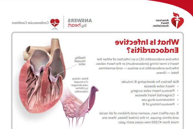 Answers by Heart infective endocarditis